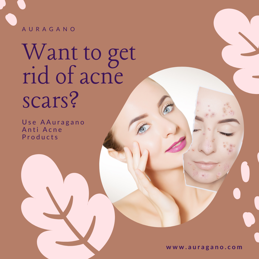 Tea tree oil serum for acne prone skin in pakistan reviews